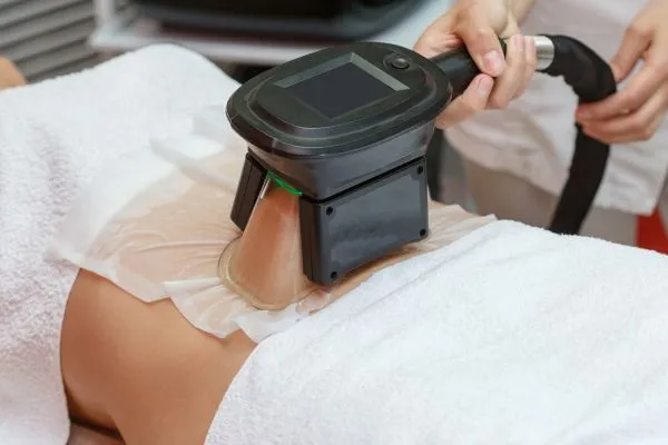 Image of person having fat freezing treatment to help weight gain Govan