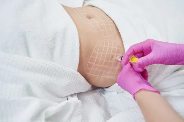 image of fat dissolving injections on love handles to help combat weight gain Govan