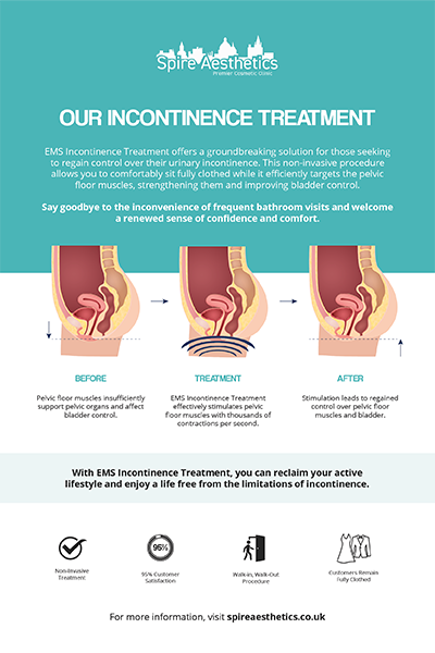 image of how urge incontinence Govan treatment works